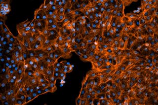  Foetal lung cells from rats. The cell nuclei are shown in blue and the actin filaments of the cytoskeleton in orange.